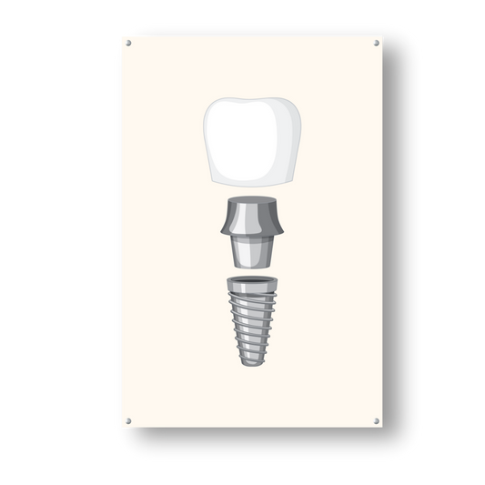 Fragmented Dental Implant - Dr Picture